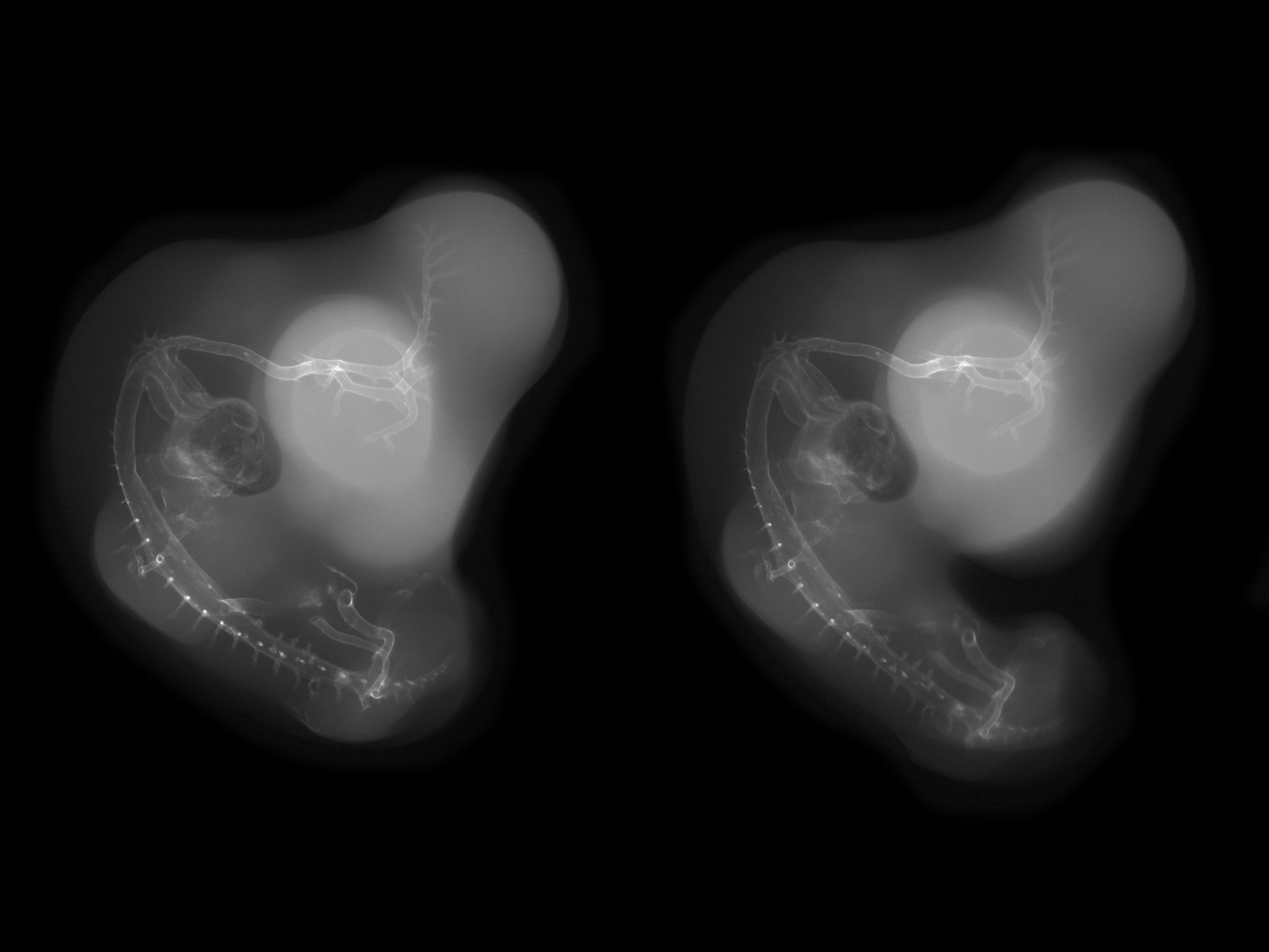 stage 27 chick embryo x-ray