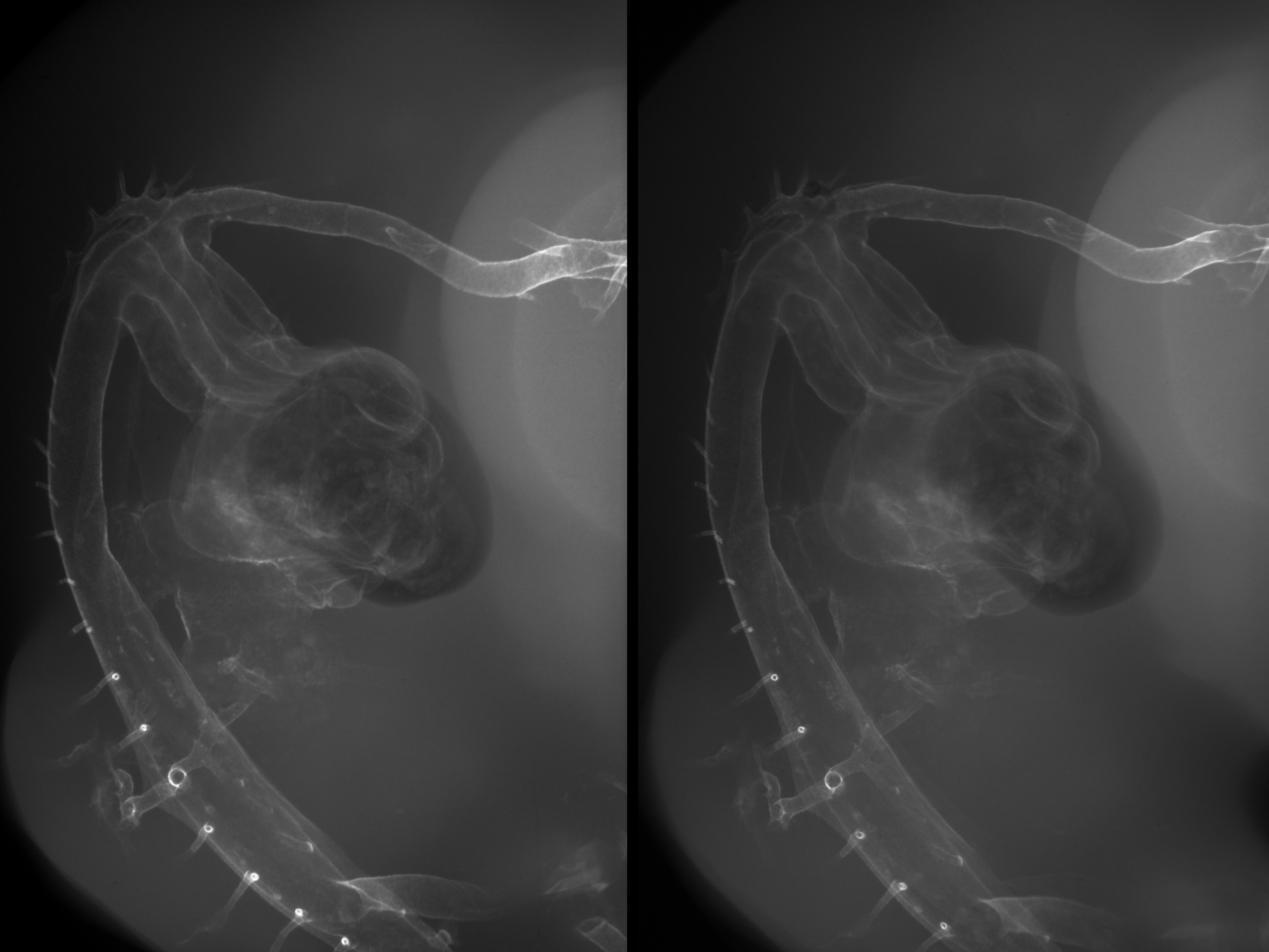 stage 27 chick embryo x-ray