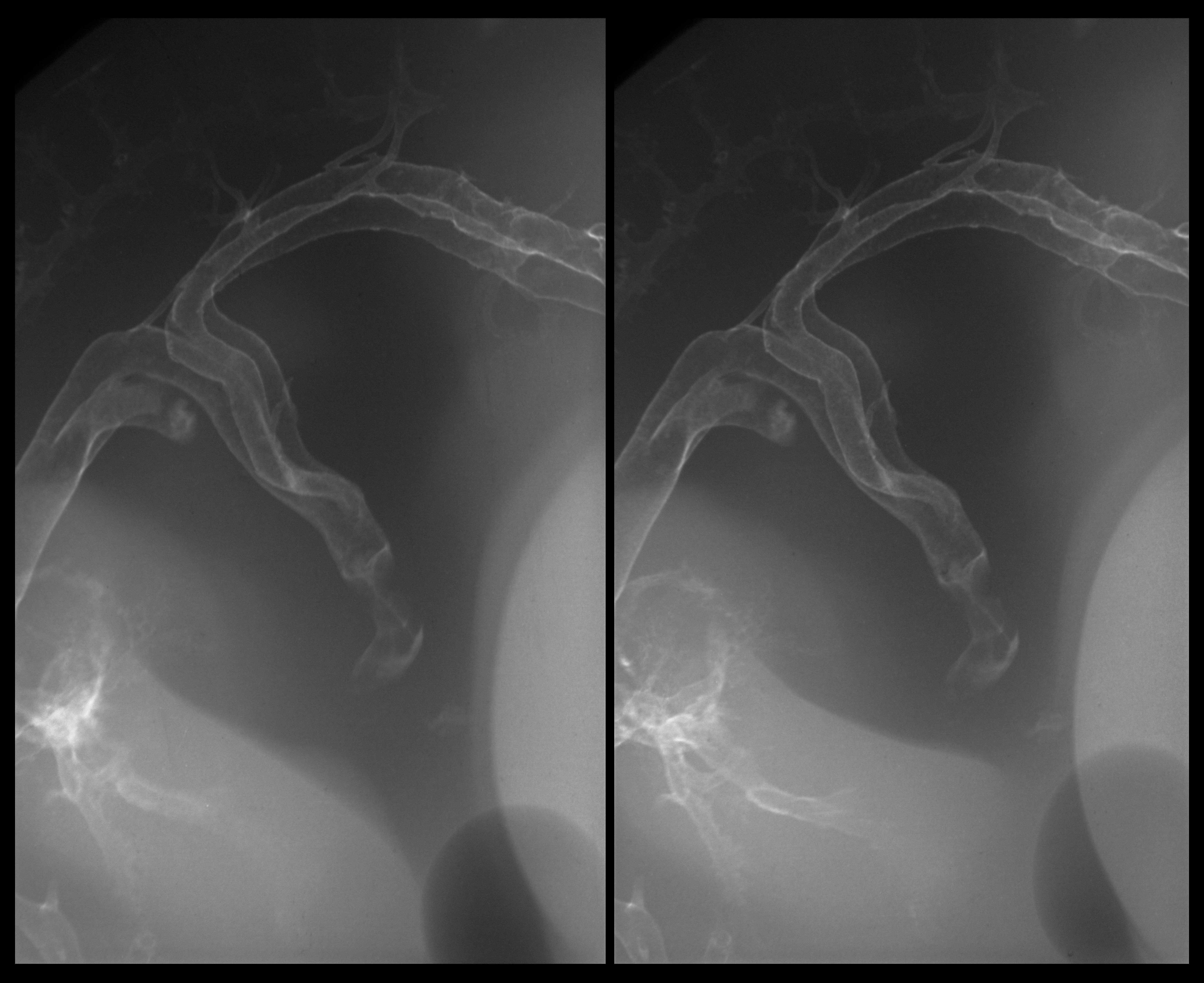 stage 28 chick embryo x-ray