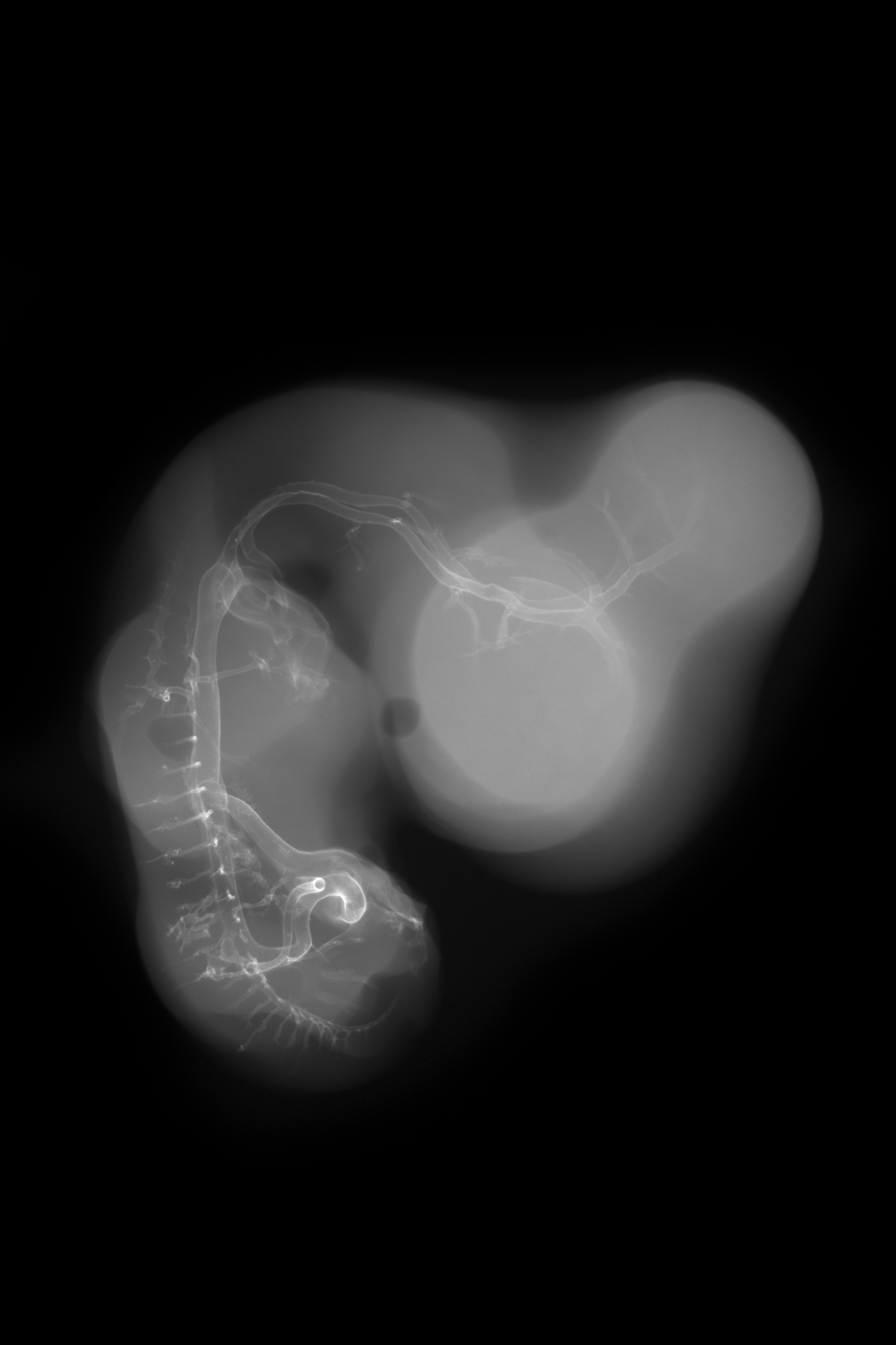 stage 28 chick embryo x-ray