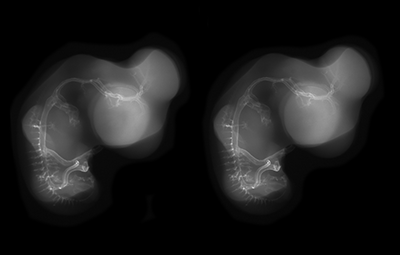 stage 28 chick embryo x-ray