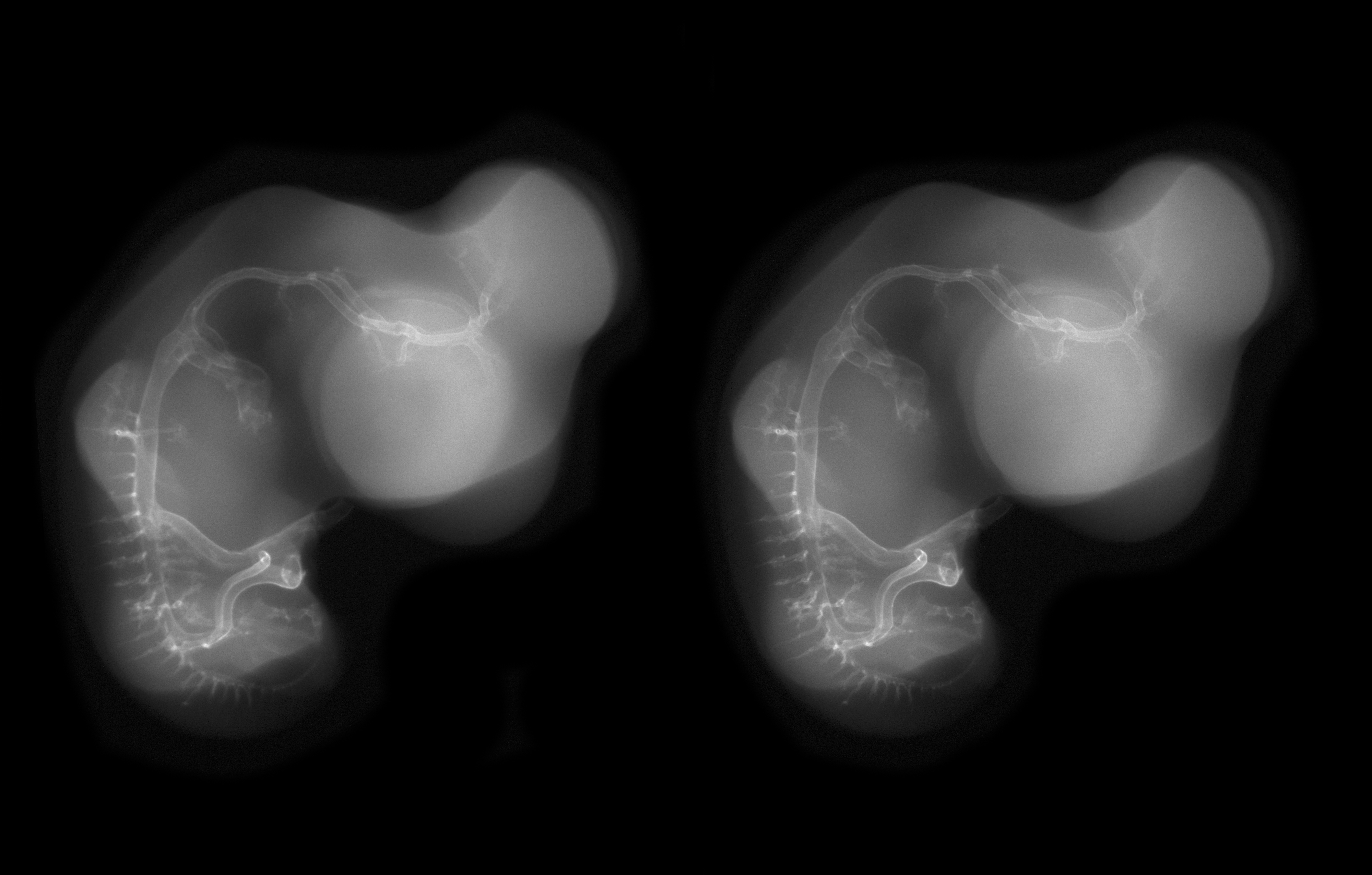 stage 28 chick embryo x-ray