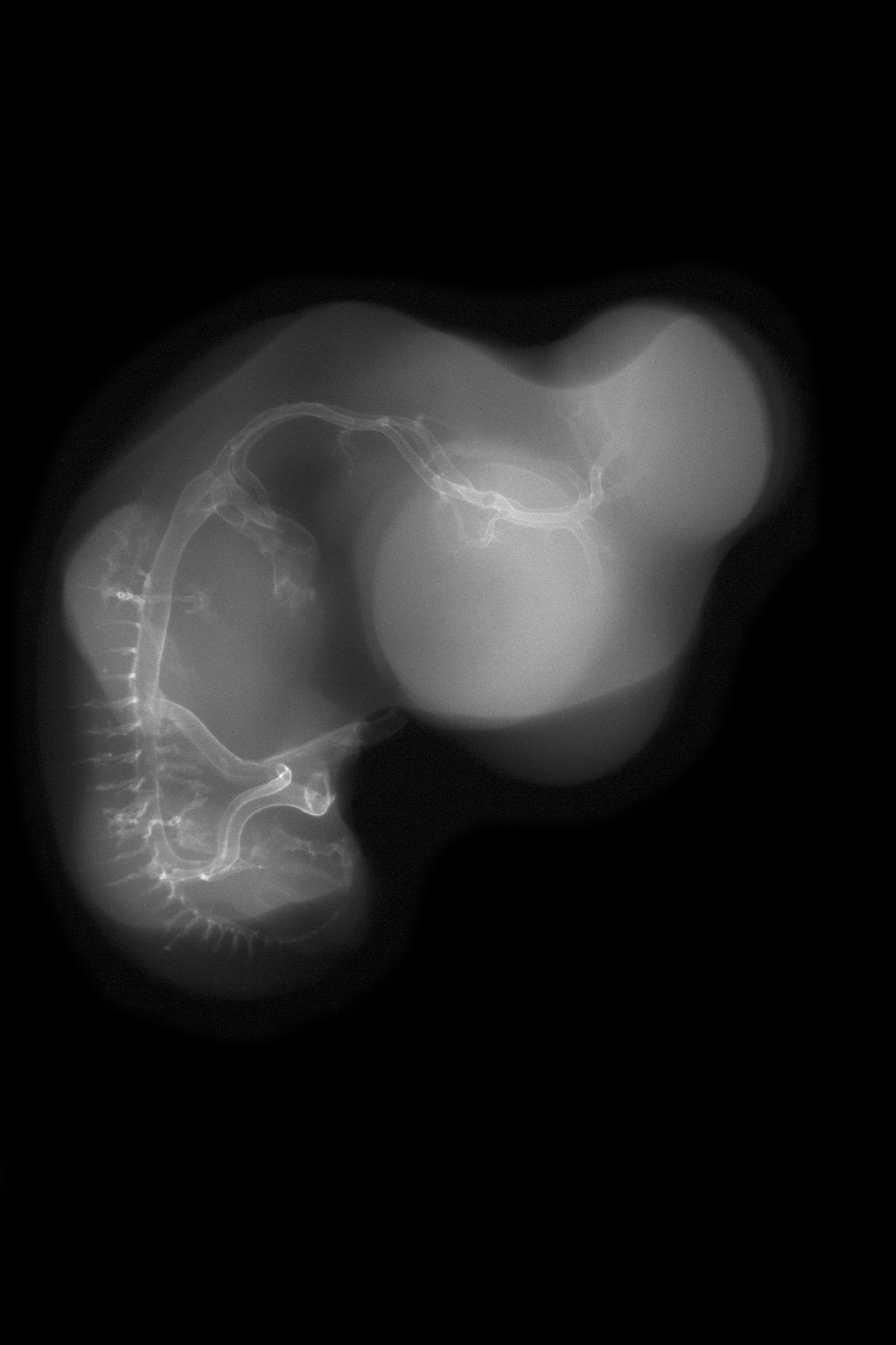 stage 28 chick embryo x-ray