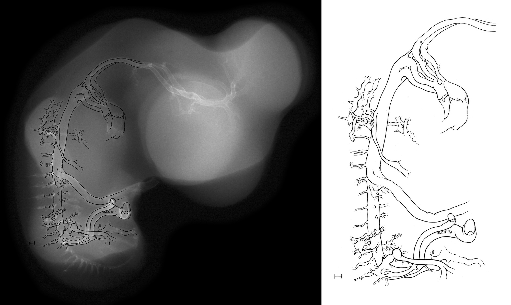 stage 35 chick embryo x-ray