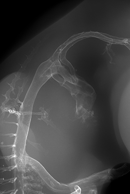 stage 28 chick embryo x-ray