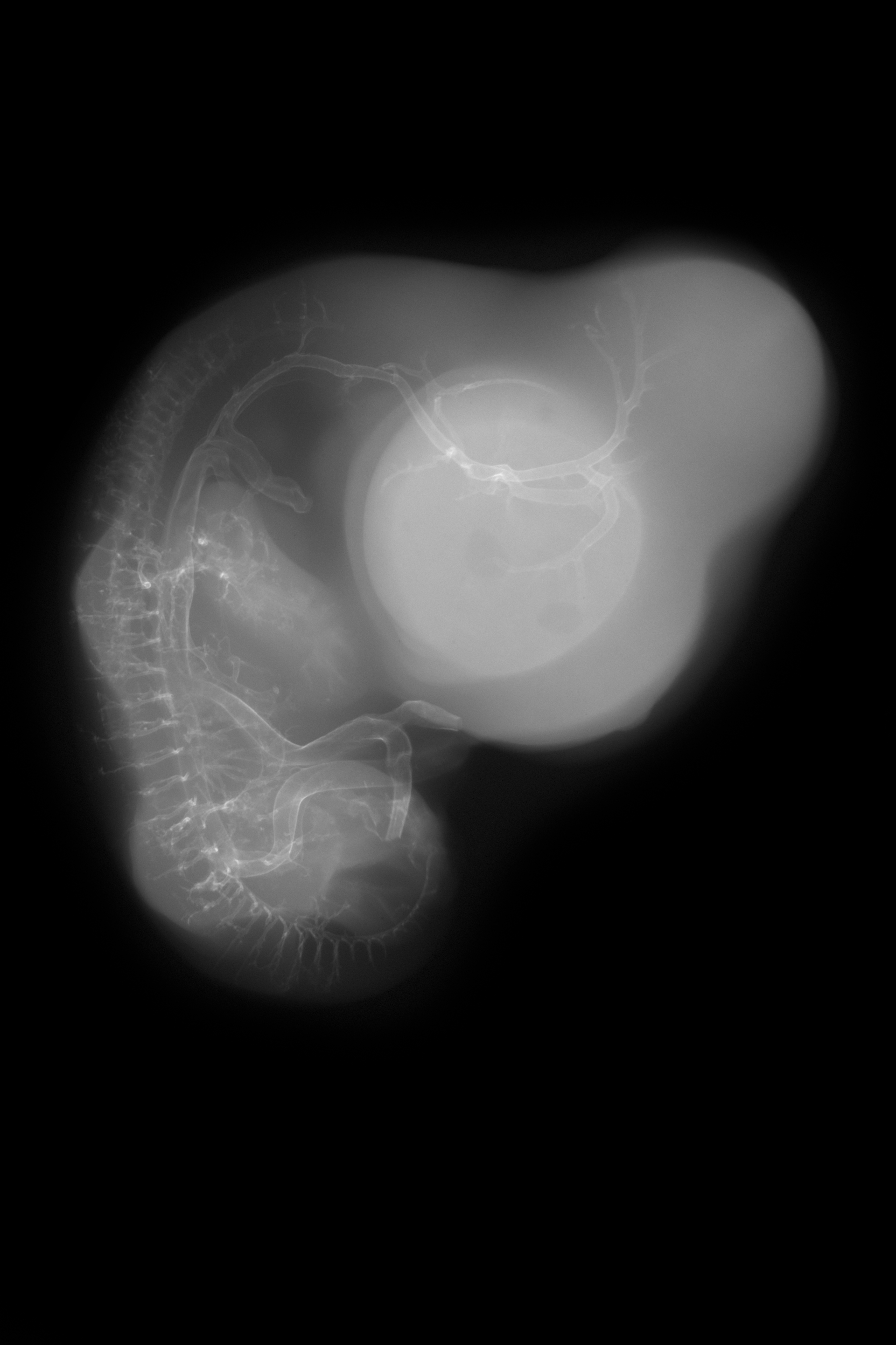 stage 29 chick embryo x-ray