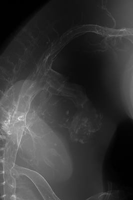 stage 29 chick embryo x-ray