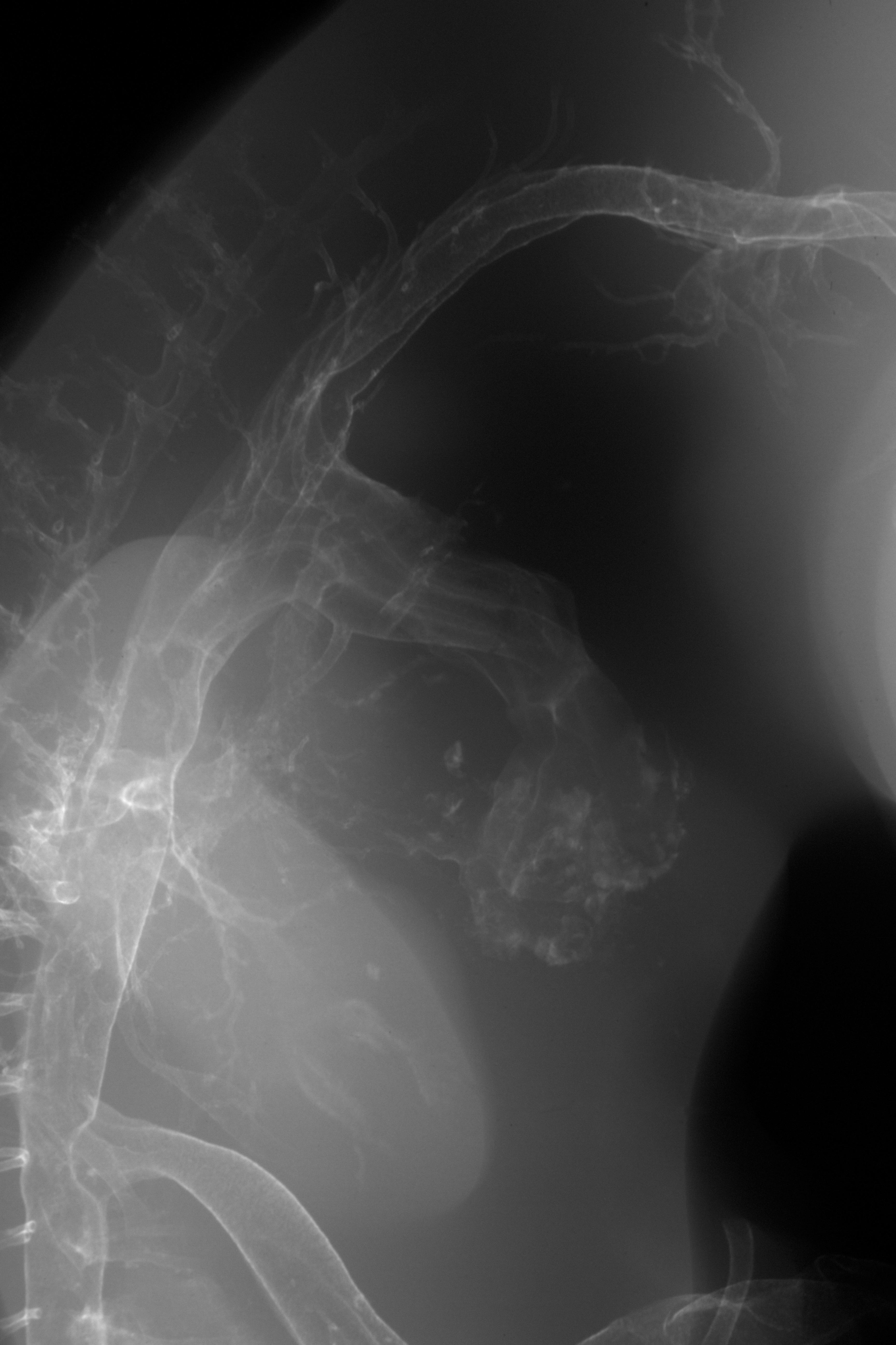 stage 29 chick embryo x-ray