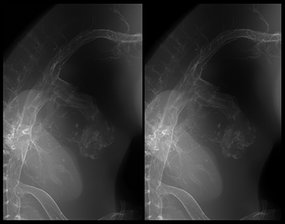 stage 29 chick embryo x-ray