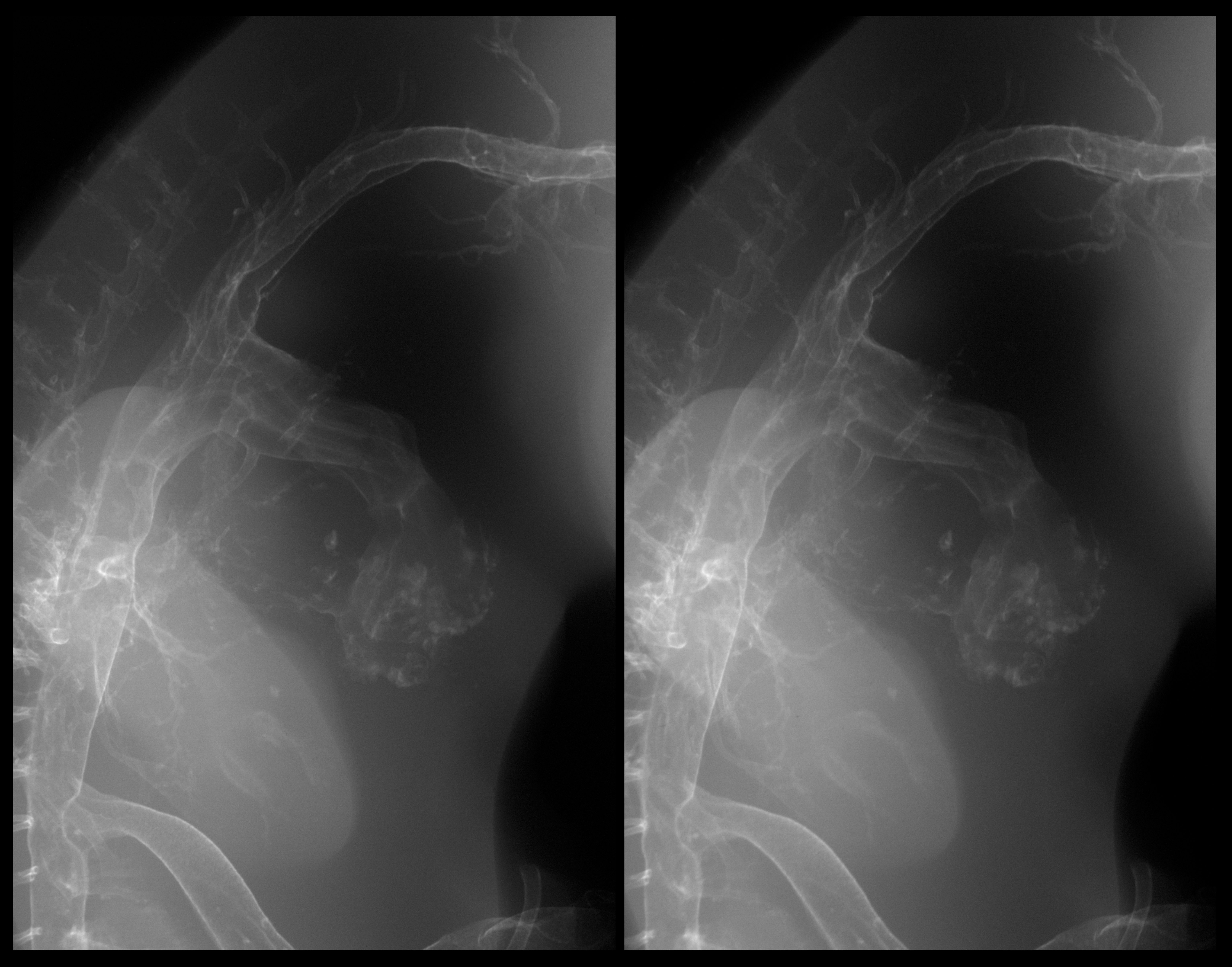 stage 29 chick embryo x-ray