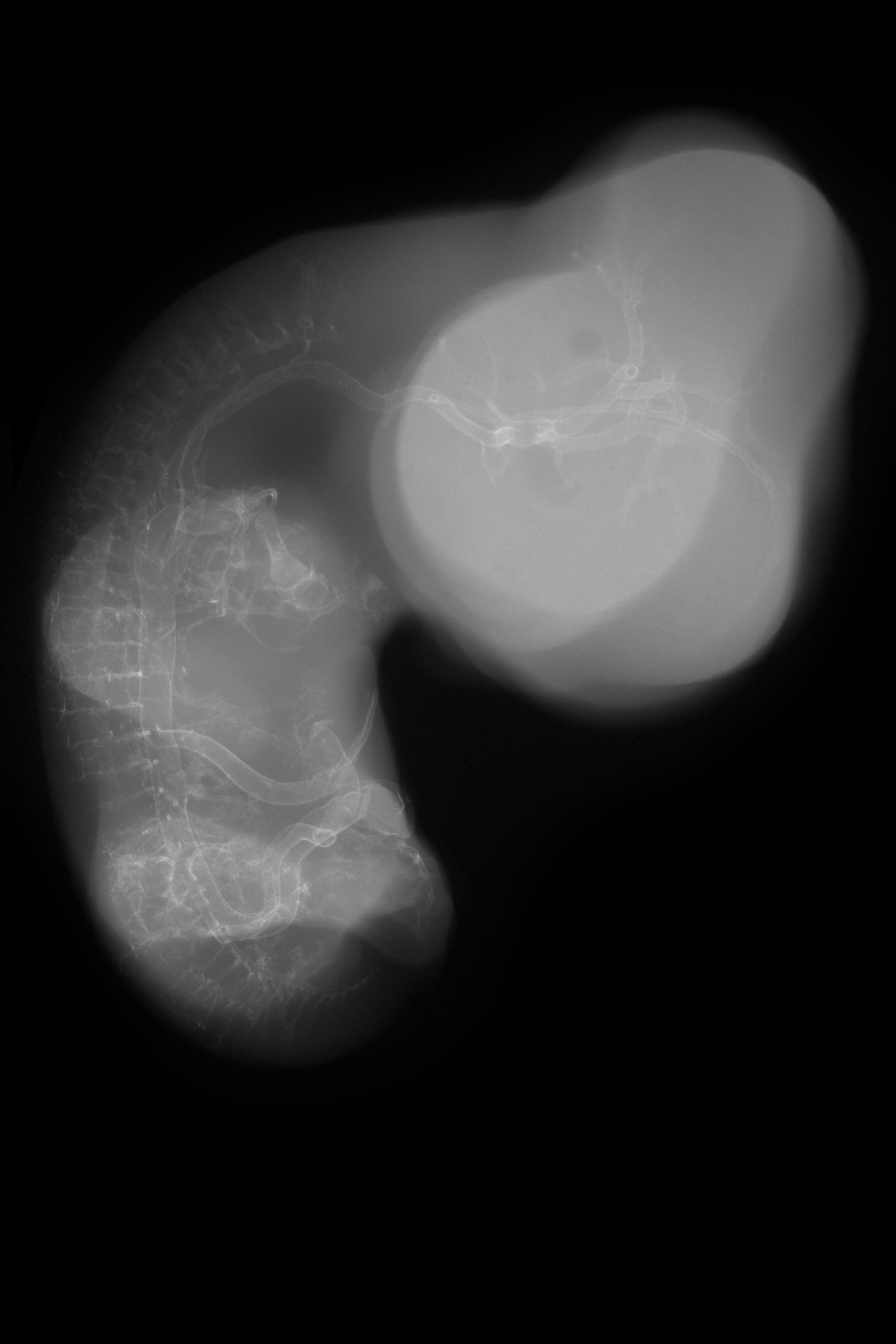 stage 29 chick embryo x-ray