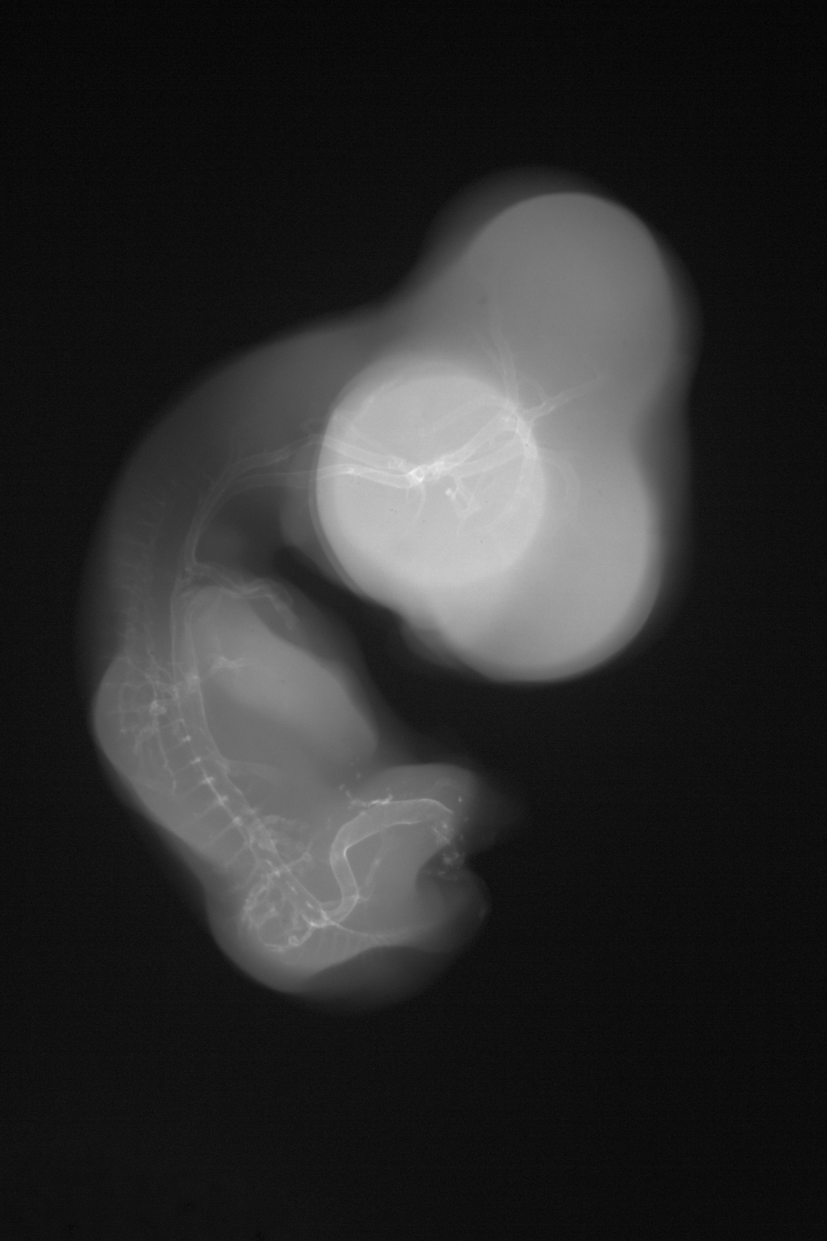 stage 29 chick embryo x-ray
