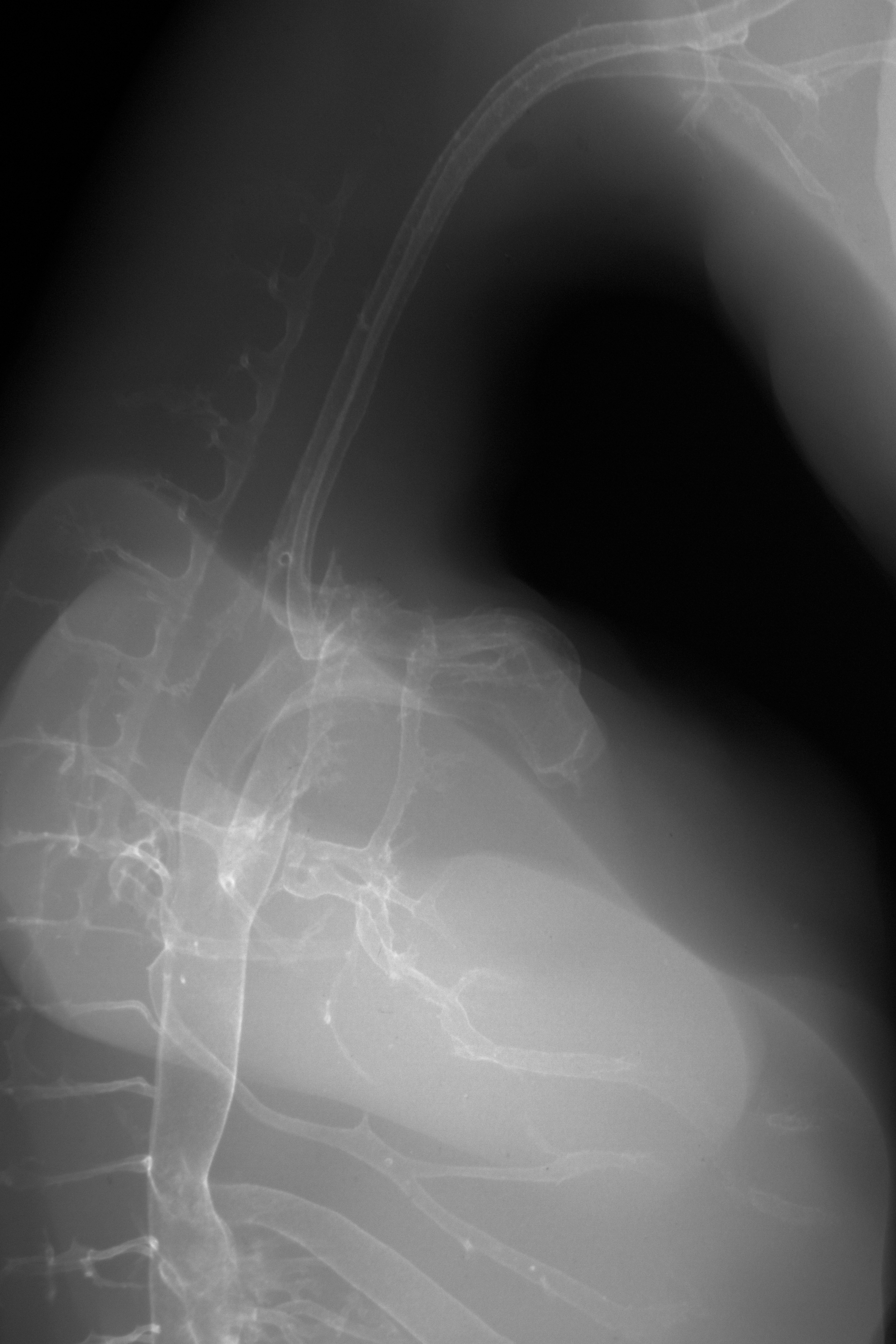 stage 30 chick embryo x-ray