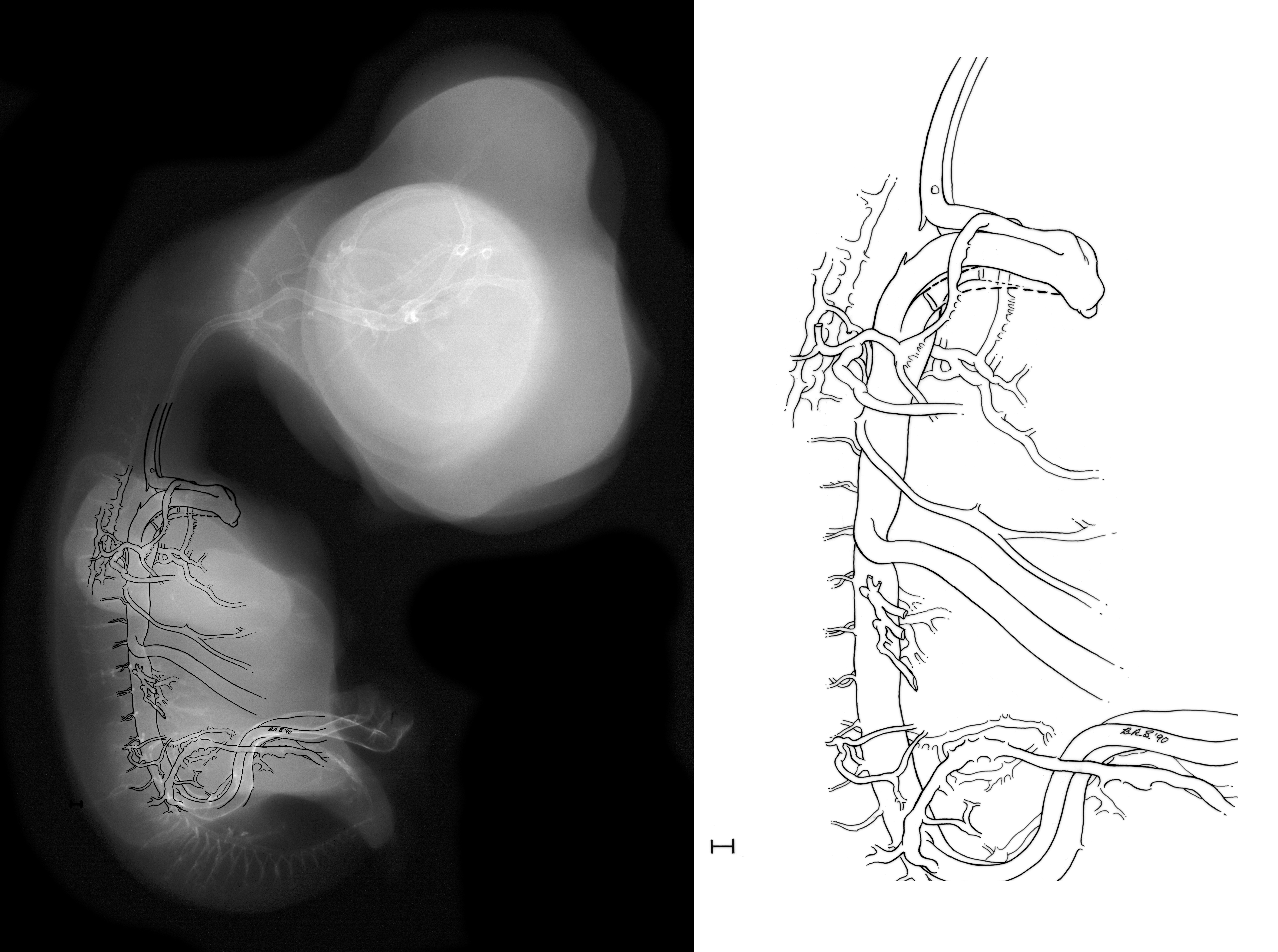 stage 35 chick embryo x-ray