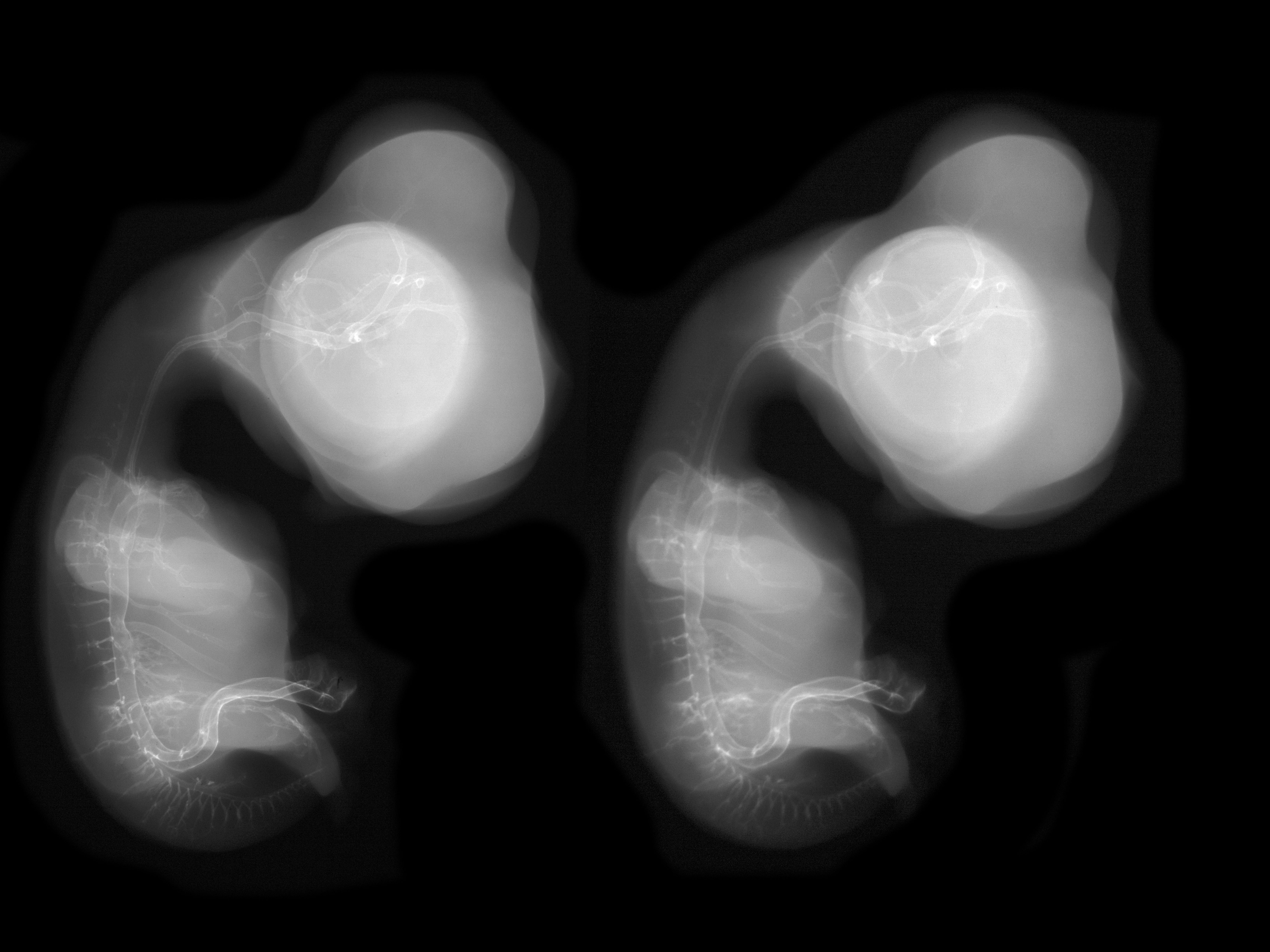 stage 30 chick embryo x-ray