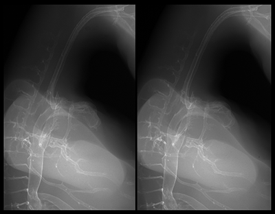 stage 30 chick embryo x-ray