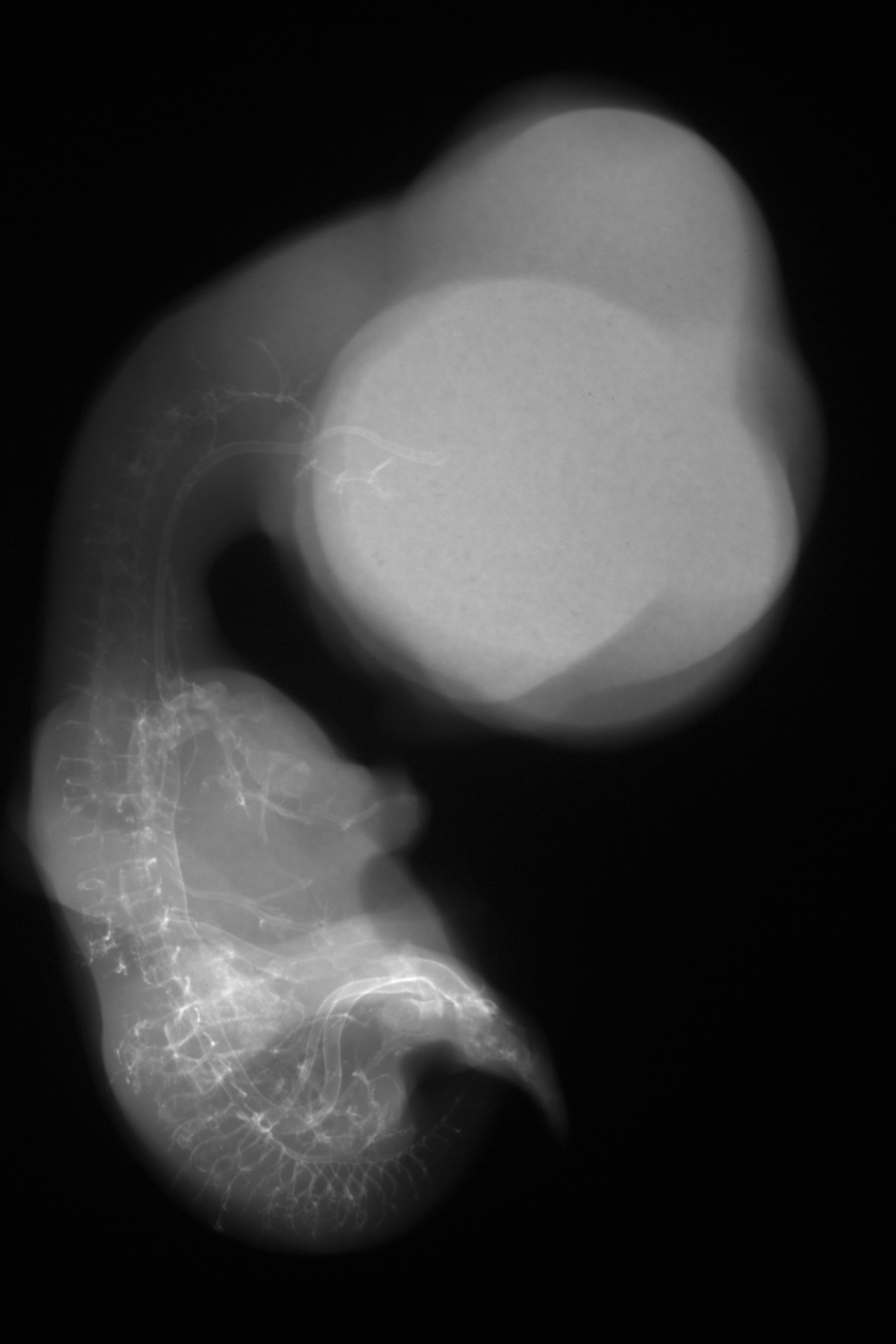 stage 30 chick embryo x-ray