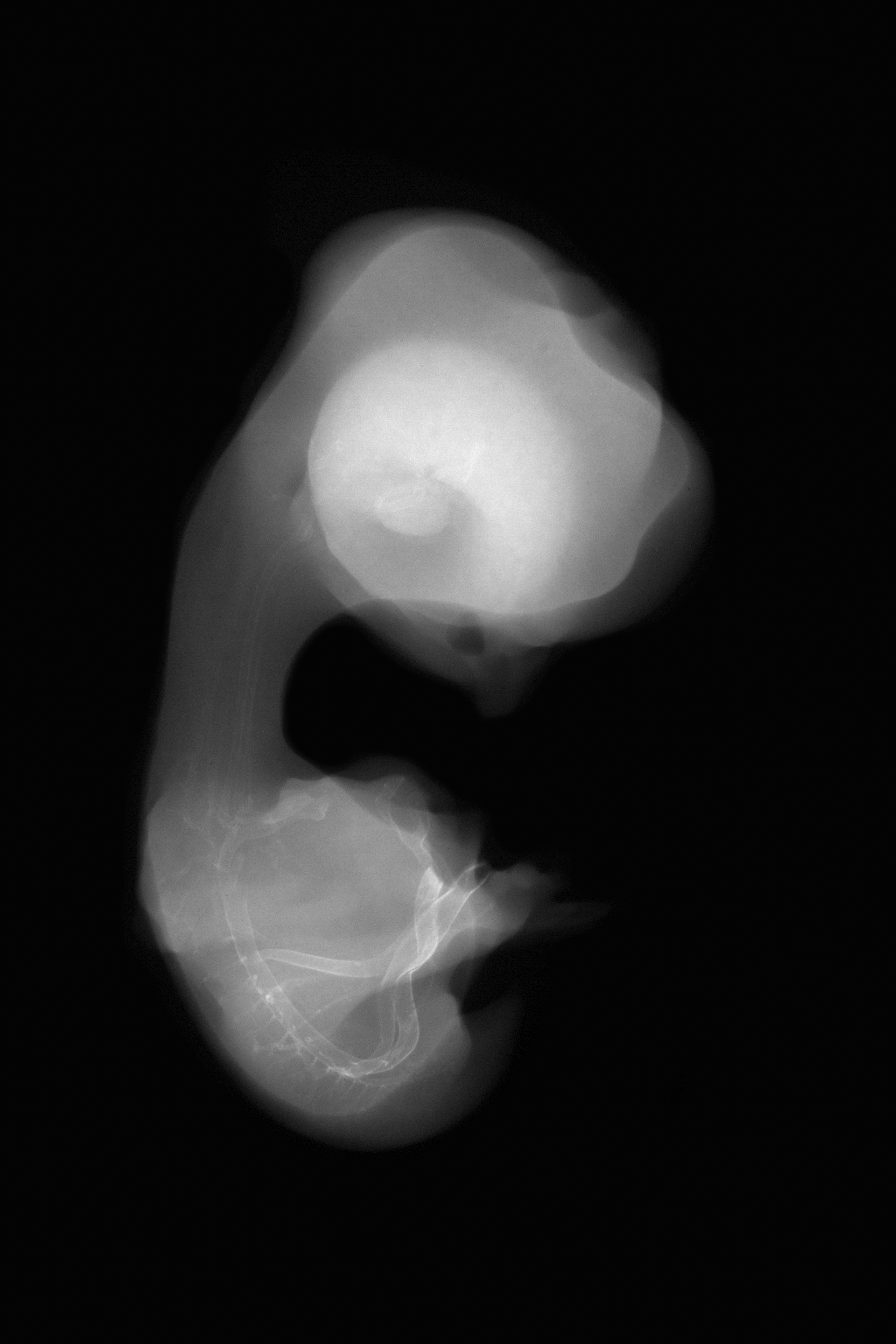 stage 31 chick embryo x-ray