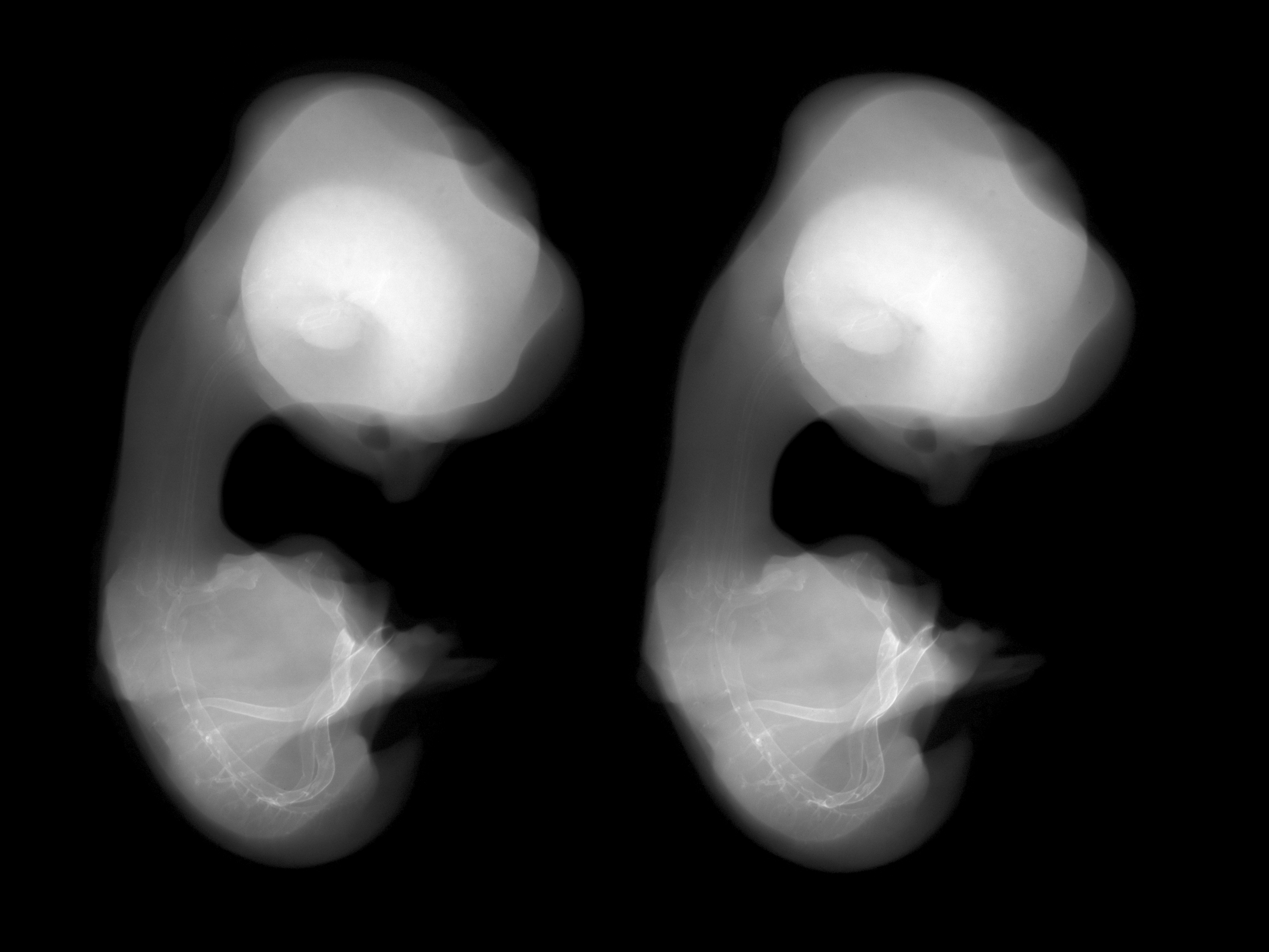 stage 31 chick embryo x-ray