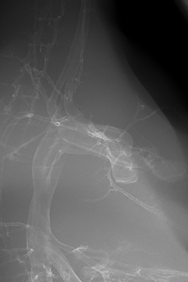stage 35 chick embryo x-ray