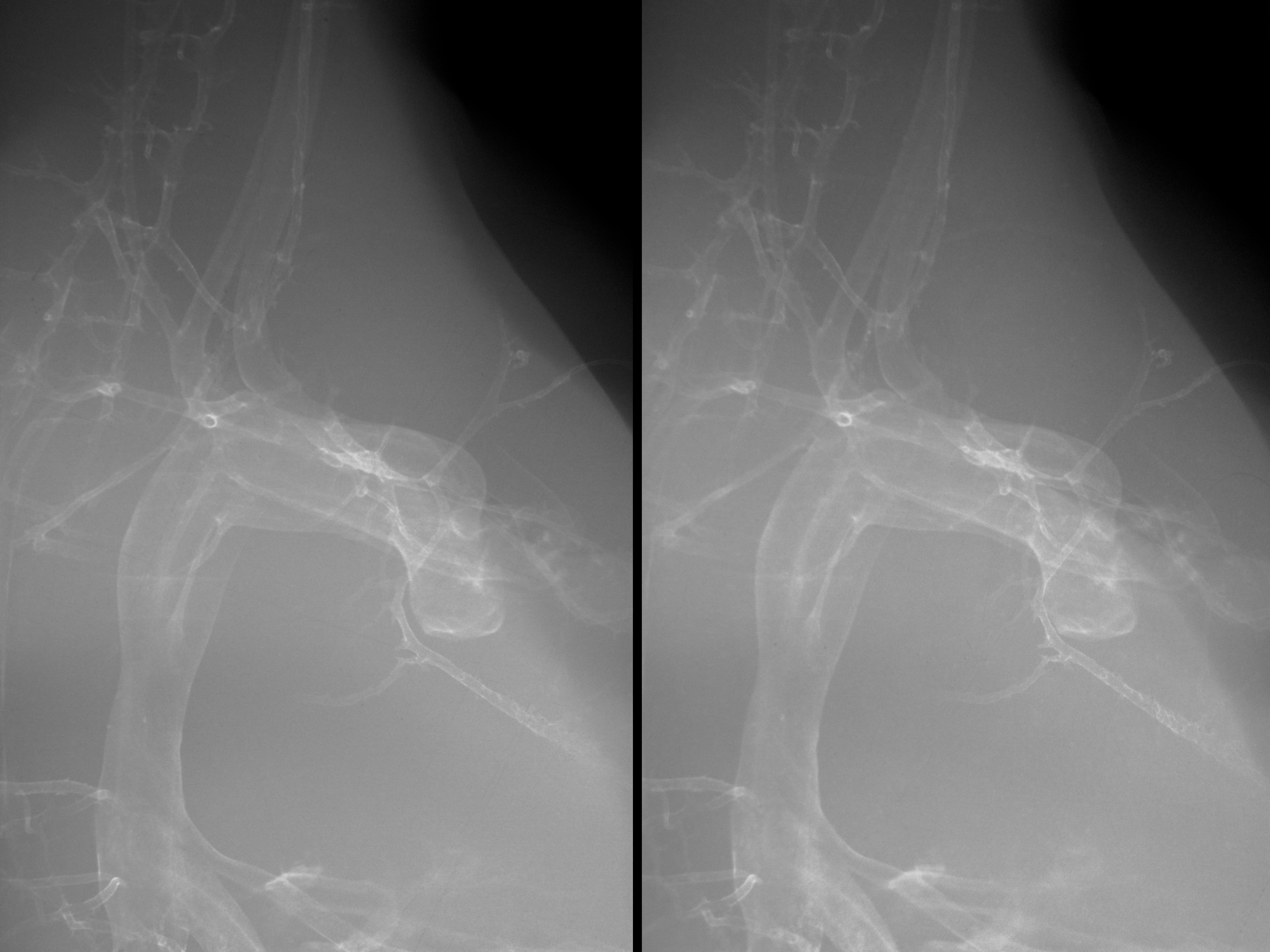 stage 35 chick embryo x-ray
