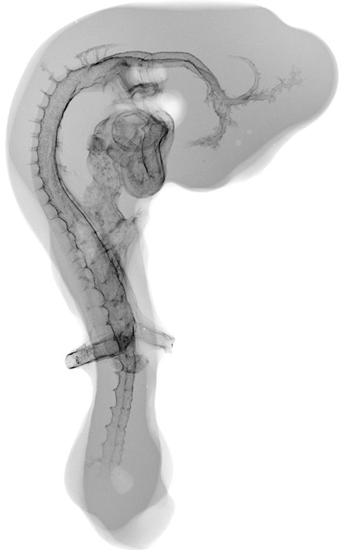 Chick Embryo X-rays Logo