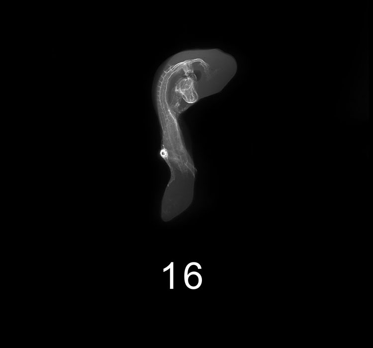 Stage 16 Embryo Image