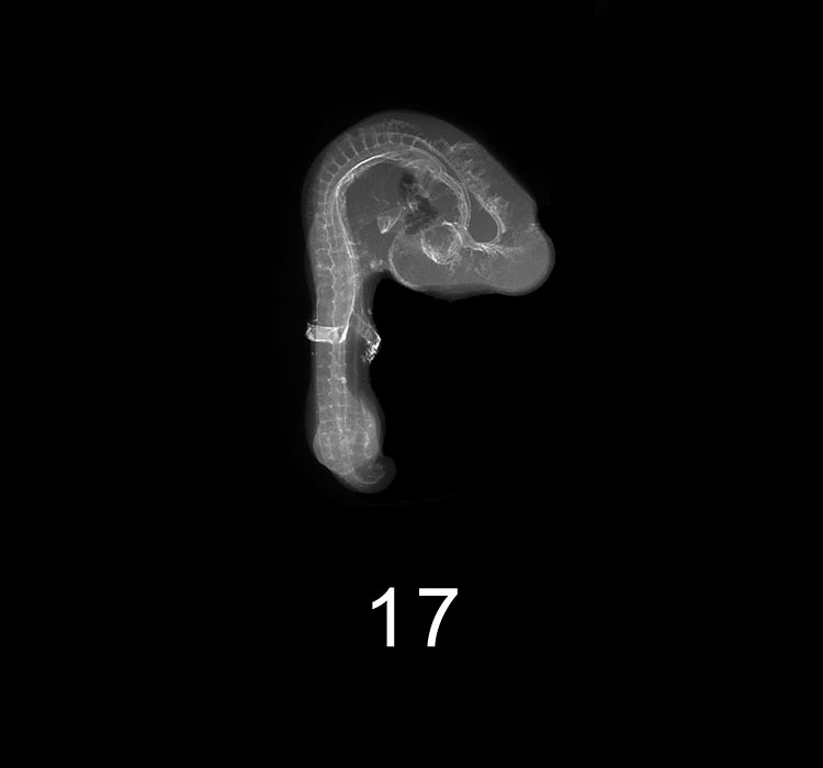 Stage 17 Embryo Image