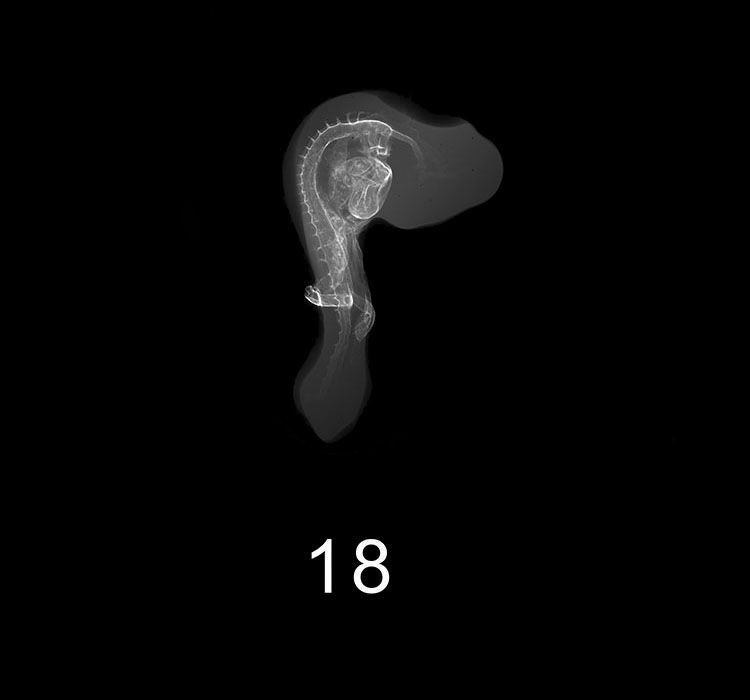 Stage 18 Embryo Image