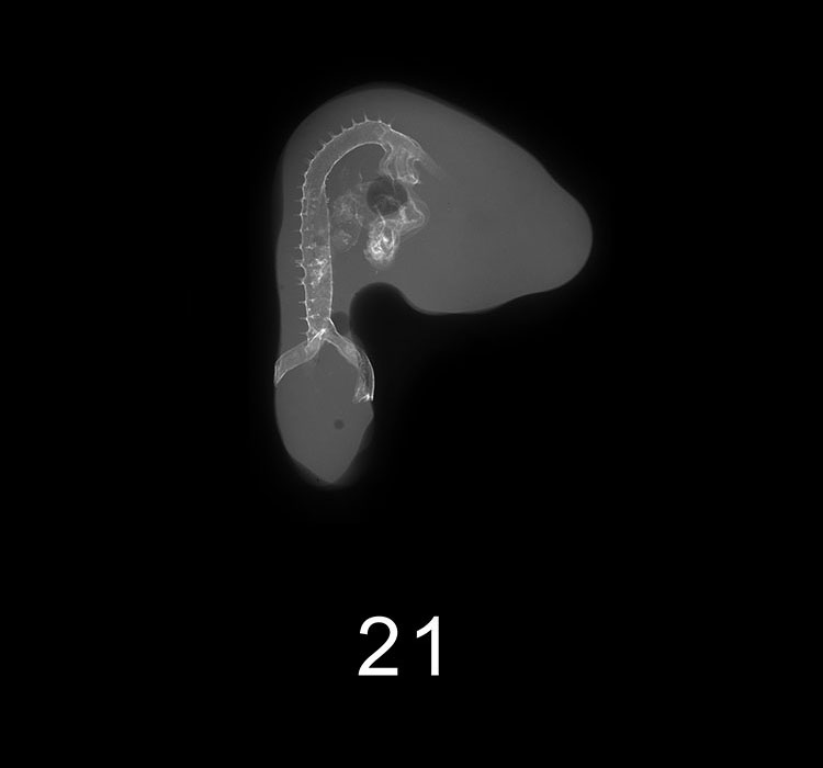 Stage 21 Embryo Image