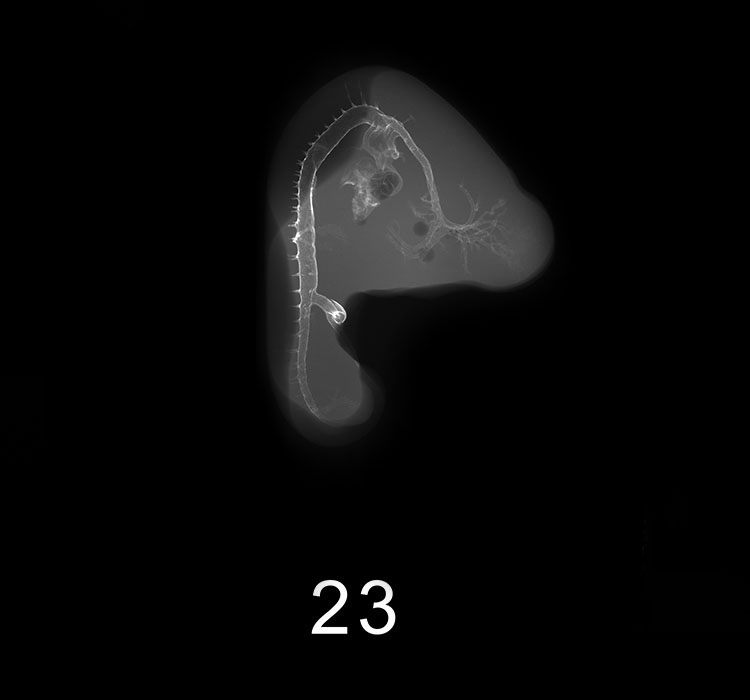 Stage 20 Embryo Image