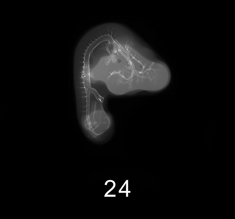 Stage 21 Embryo Image