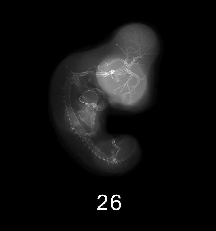 Stage 23 Embryo Image